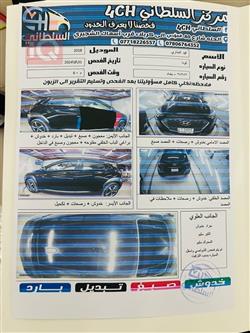 هیوندای کۆنا